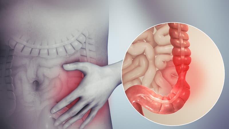 nguyên nhân gây rối loạn tiêu hóa