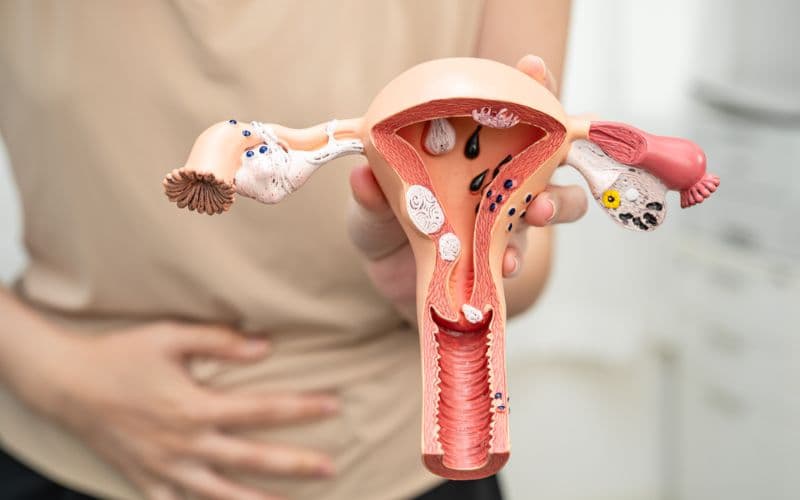 sau khi đốt viêm lộ tuyến bị ra máu nhiều