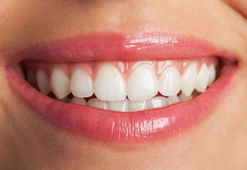 Sau khi lấy cao răng có được đánh răng không?
