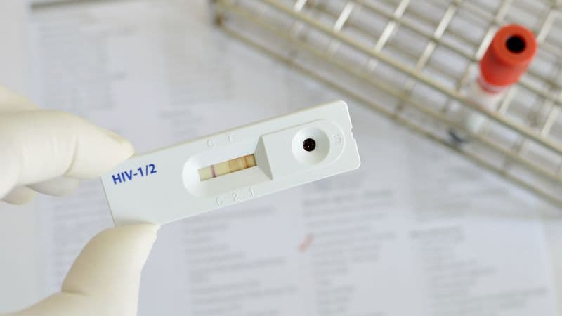 xét nghiệm HIV