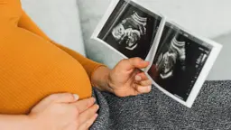Thai 38 tuần chu vi vòng đầu bao nhiêu?