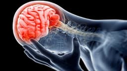 Thang điểm ICH trong xuất huyết não