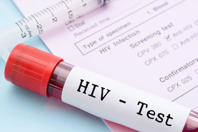 xét nghiệm HIV