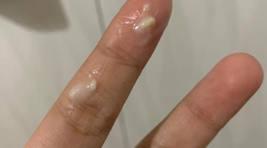 Những thay đổi bất thường tại vùng kín có thể là tín hiệu cảnh báo viêm nhiễm cần được kiểm tra sớm.