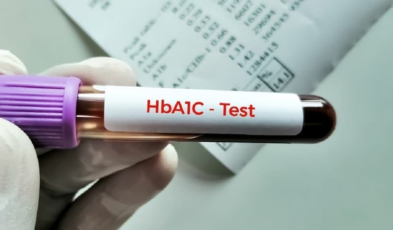 Glucose gắn kết với hemoglobin tạo thành HbA1c.