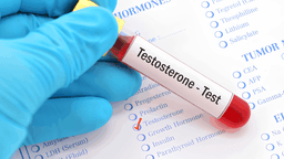 Xét nghiệm testosterone: Ý nghĩa chỉ số, quy trình và lưu ý chuẩn bị