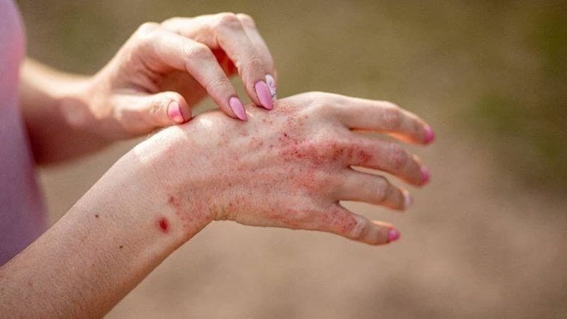 Không nên tự ý điều trị mọi bệnh da liễu tại nhà, đặc biệt khi chưa xác định rõ nguyên nhân