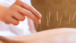 Tiêu chí lựa chọn bác sĩ Y học cổ truyền giỏi ở Thạch Khôi – Hải Phòng