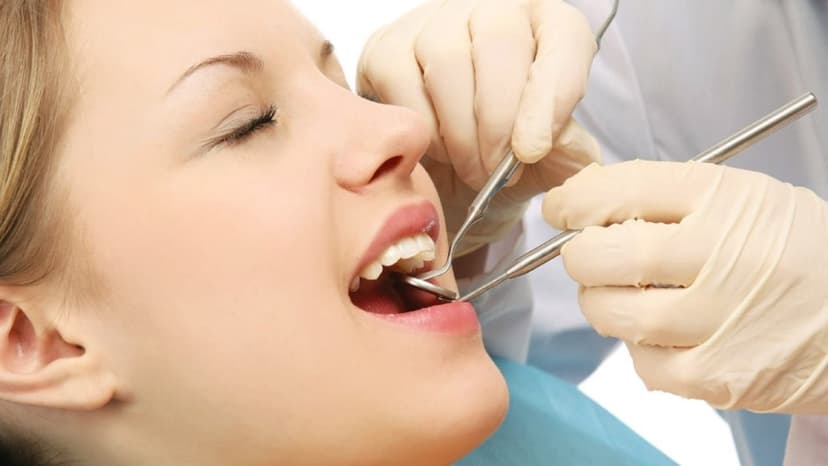 Cạo vôi răng: Bí quyết sở hữu nụ cười khỏe mạnh và rạng rỡ