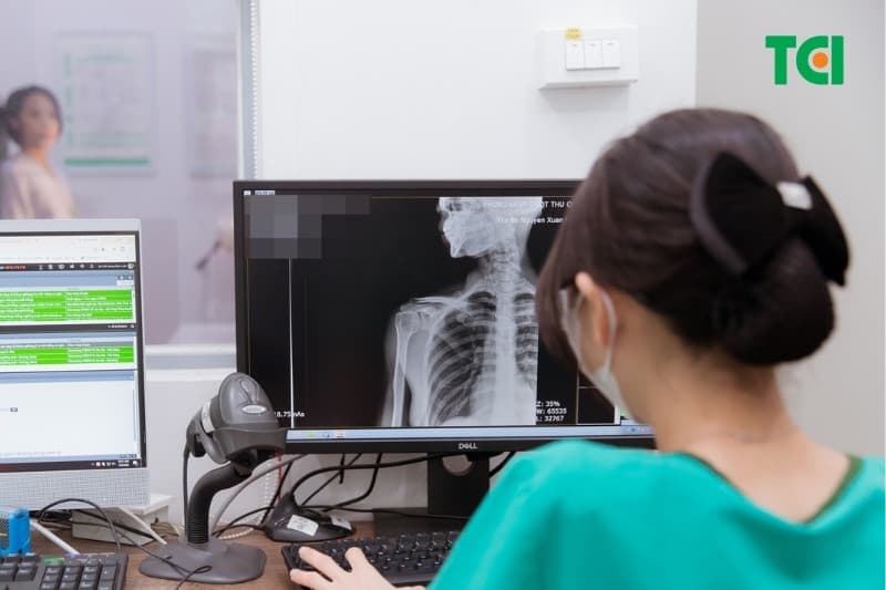 Chẩn đoán đau khớp vai cần kết hợp triệu chứng đau vai, tiền sử bệnh, khám lâm sàng và các hệ thống chẩn đoán hình ảnh