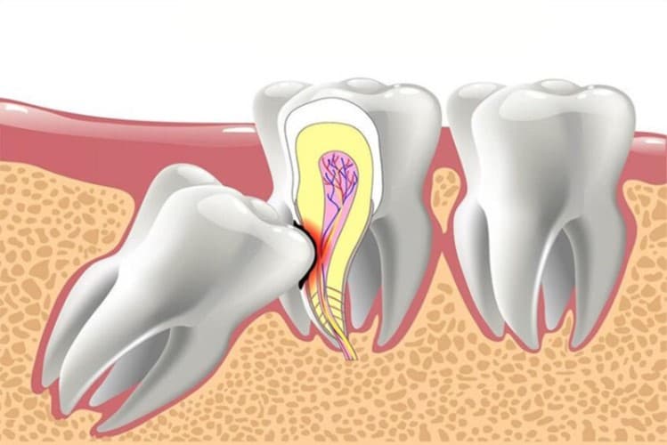 Đặc điểm cấu tạo và thời điểm mọc răng số 7