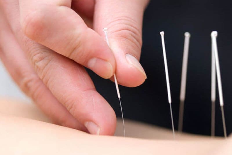 Việc thăm khám và chỉ định điều trị bằng Y học cổ truyền cần được thực hiện bởi người có chuyên môn phù hợp