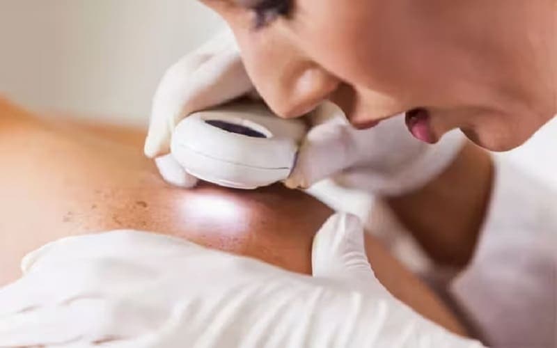 Thăm khám kỹ giúp phân loại và lựa chọn phương pháp điều trị ung thư da phù hợp