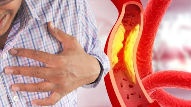 Hẹp động mạch vành có nguy hiểm không?