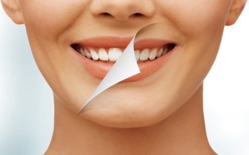 Làm sao để trắng răng ngay tại nhà an toàn và hiệu quả