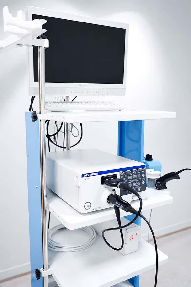 Hệ thống nội soi Olympus CV-170 hỗ trợ bác sĩ quan sát rõ niêm mạc đường tiêu hóa.