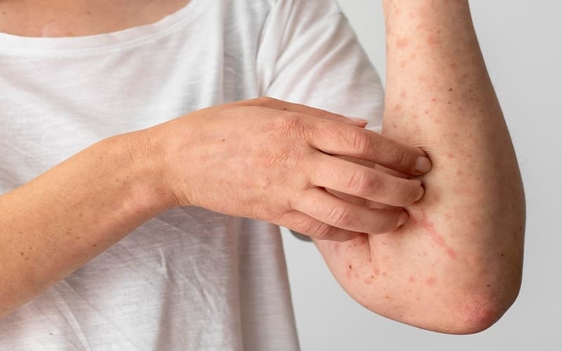 Những dấu hiệu bất thường trên da cần được thăm khám để xác định đúng nguyên nhân và hướng xử trí
