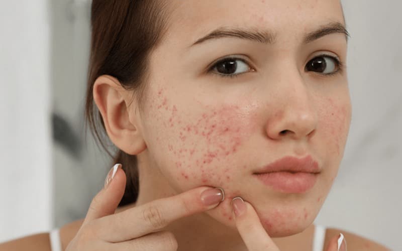 Những vấn đề về da liễu được người dân Tân Hưng quan tâm