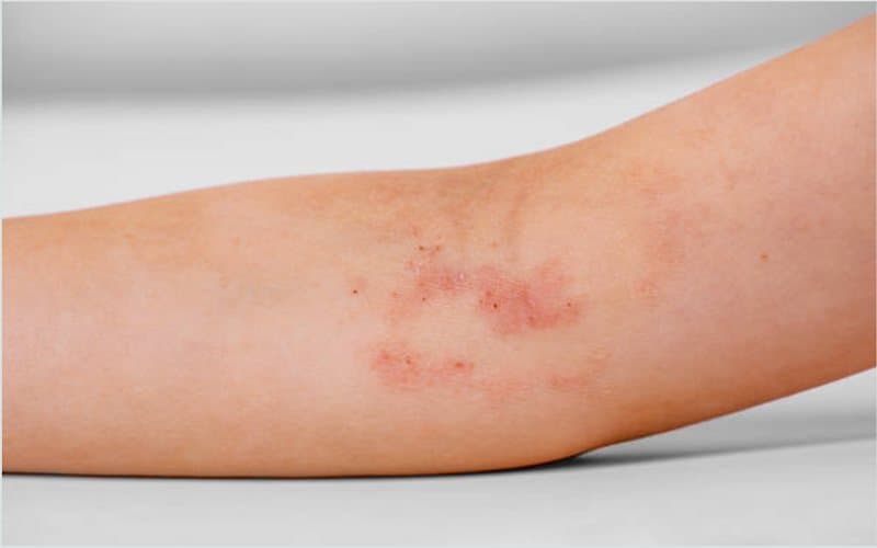 Cách chọn phòng khám phù hợp với từng bệnh lý da liễu