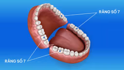 Răng số 7: Chức năng, dấu hiệu hư tổn và giải pháp phục hồi toàn diện