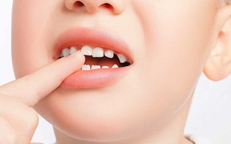 Sự phát triển của hàm răng qua các giai đoạn