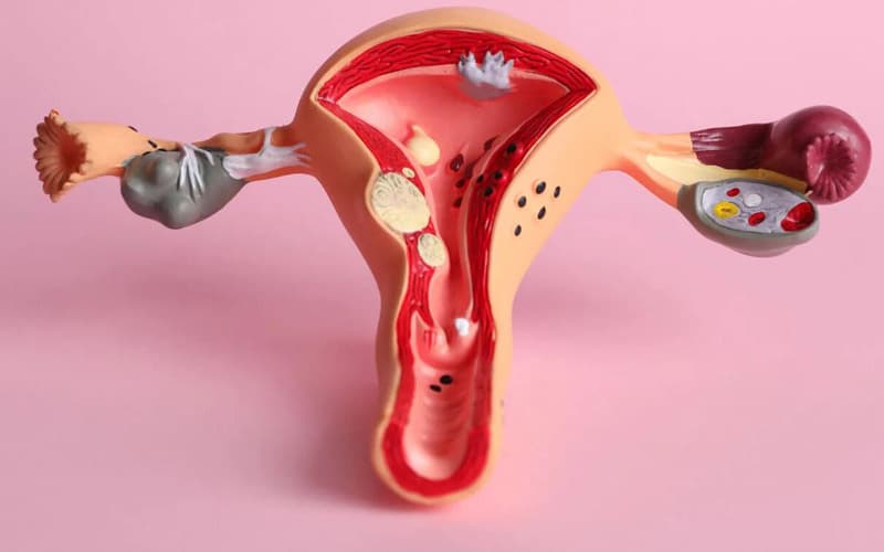 Viêm âm hộ ở giai đoạn đầu có thể chỉ gây khó chịu nhẹ, nhưng nếu chủ quan, tình trạng viêm có thể kéo dài