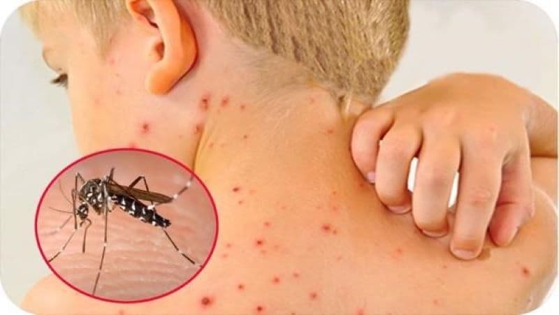 Lau mát bằng nước ấm và mặc quần áo thoáng giúp trẻ dễ chịu hơn khi sốt.