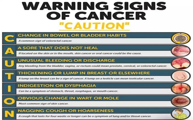 Bộ quy tắc CAUTION cần nhớ