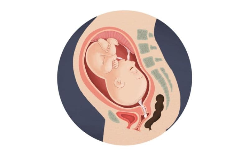 Rạch tầng sinh môn không phải là thủ thuật bắt buộc đối với tất cả các ca sinh thường