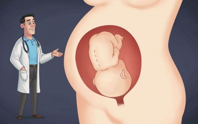 Đau và sưng nhẹ trong những ngày đầu sau sinh có thể xuất hiện, nhưng triệu chứng thường giảm dần