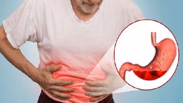Điều trị bệnh dạ dày an toàn tại nhà như thế nào?