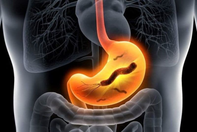 Điều trị nhiễm trùng dạ dày phụ thuộc vào nguyên nhân