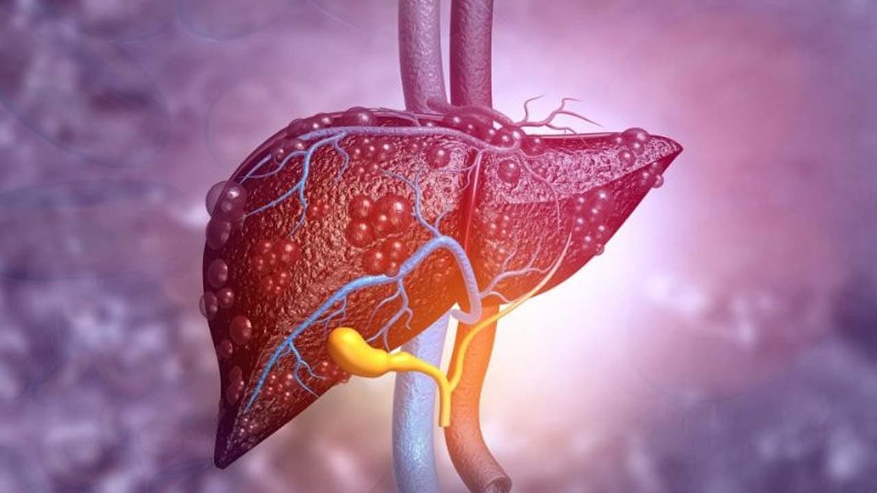 Những triệu chứng báo hiệu rối loạn chức năng gan