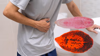 Ấu trùng sán lá gan: Đường lây, chẩn đoán và điều trị