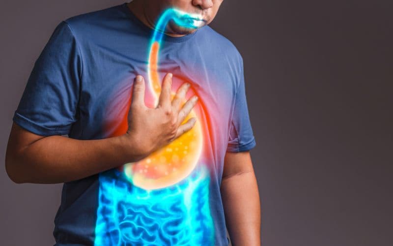 Triệu chứng trào ngược dạ dày thường gặp nhất là ợ nóng và trào ngược