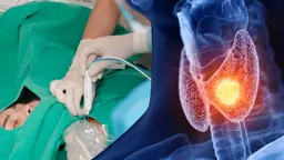 Ung thư tuyến giáp có đốt sóng cao tần được không?