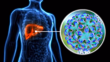 Viêm gan virus B đồng nhiễm viêm gan virus D là gì và mức độ nguy hiểm ra sao?