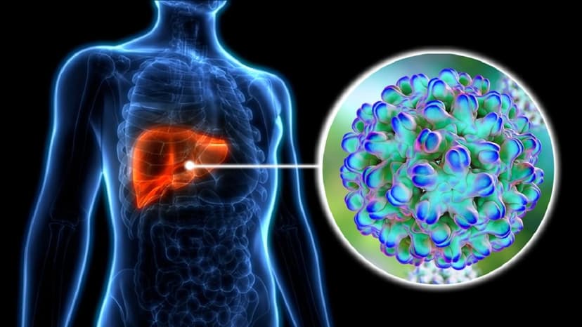 Viêm gan virus B đồng nhiễm viêm gan virus D là gì và mức độ nguy hiểm ra sao?