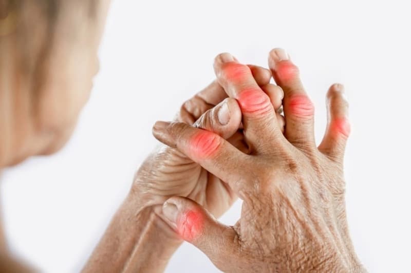 Tình trạng viêm khớp dạng thấp biến chứng tim mạch diễn ra khi các chất gây viêm di chuyển theo máu, làm xơ cứng và hẹp động mạch