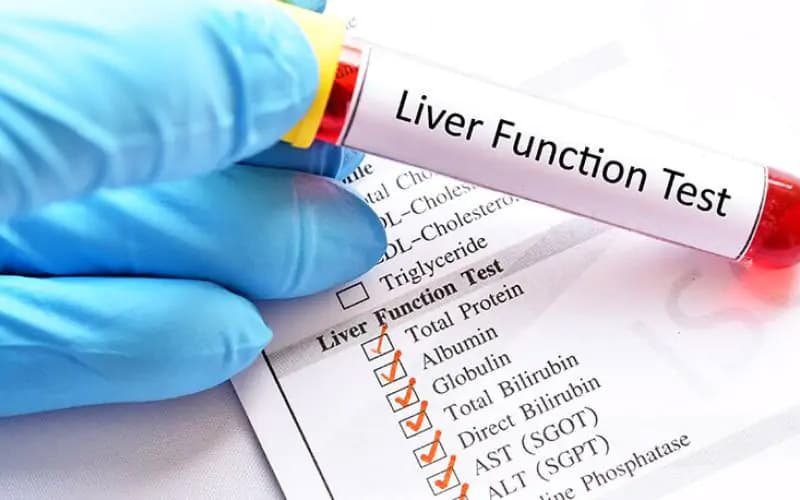 Xét nghiệm chức năng gan giúp phát hiện sớm các rối loạn