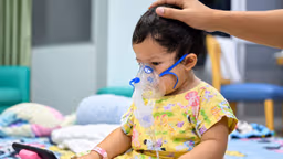 Nhiễm RSV ở trẻ: Nguyên nhân, dấu hiệu vấn đề cần lưu ý