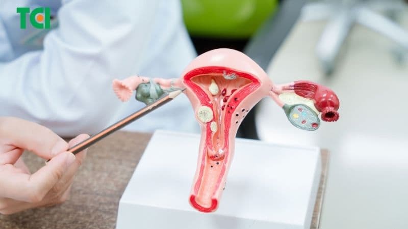 Bác sĩ có thể chỉ định theo dõi polyp cổ tử cung chưa gây triệu chứng và tái khám định kỳ, thay vì can thiệp ngay.