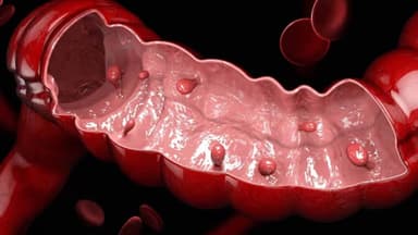 Adenoma ống đại tràng có dấu hiệu gì? Nguyên nhân do đâu và điều trị thế nào?