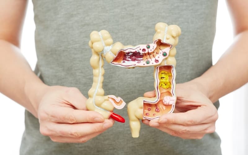 So sánh crohn và viêm loét đại tràng khác nhau như thế nào?