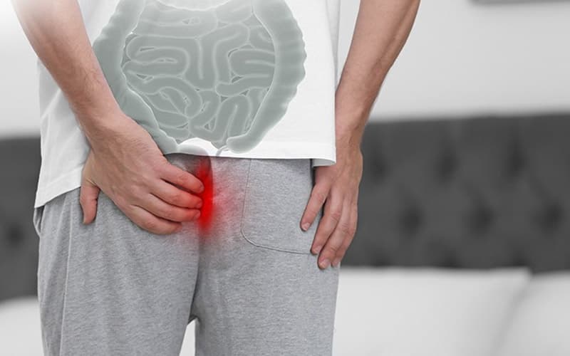 Cơn đau xuất hiện đột ngột và dữ dội là triệu chứng thường gặp của huyết khối tĩnh mạch quanh hậu môn