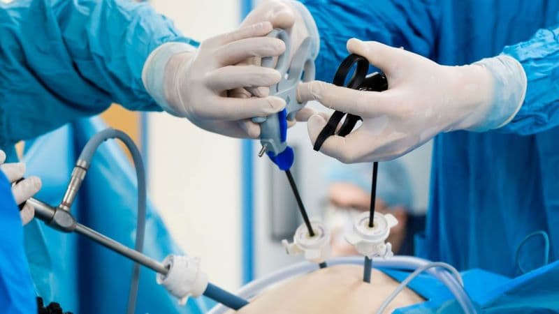 Phẫu thuật polyp đại tràng sigma không phải lựa chọn đầu tiên trong mọi trường hợp