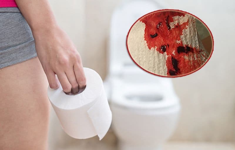 Khi bị sa trực tràng, người bệnh có cảm giác còn phân trong trực tràng dù đã đi vệ sinh.