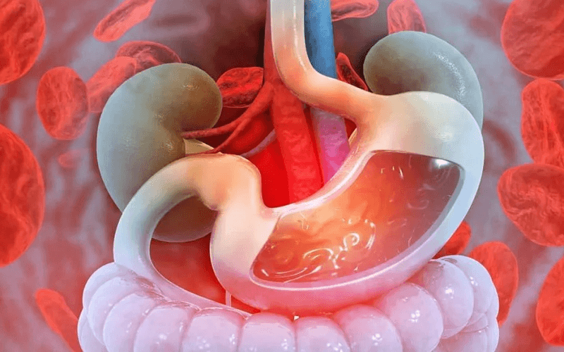 Biến chứng nguy hiểm có thể gặp phải của u tuyến tá tràng