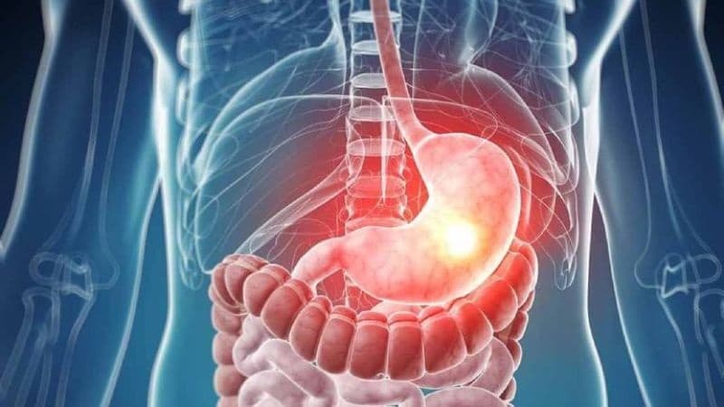 Điều trị giãn tĩnh mạch phình vị cần kiểm soát xuất huyết và ổn định tuần hoàn
