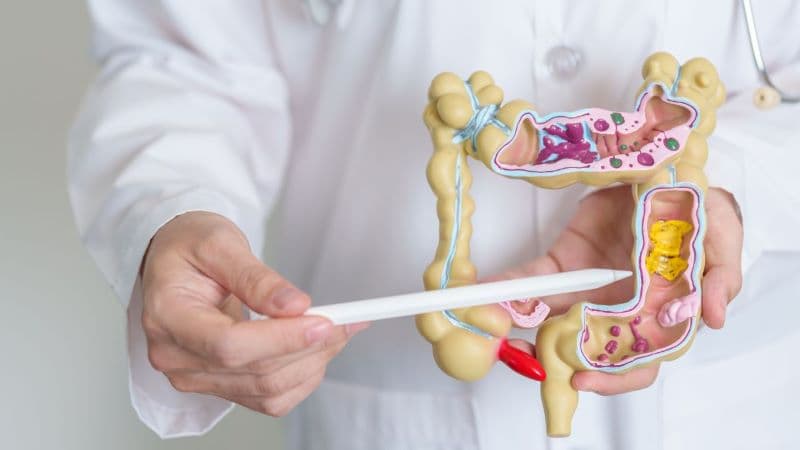Quy trình chẩn đoán polyp trực tràng thấp đòi hỏi sự tỉ mỉ để không bị nhầm lẫn với các bệnh lý thường gặp khác